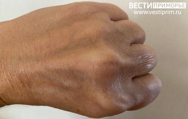 Женщина попыталась дать отпор напавшему на нее мужчине во Владивостоке Женщина попыталась дать отпор напавшему на нее мужчине во Владивостоке
