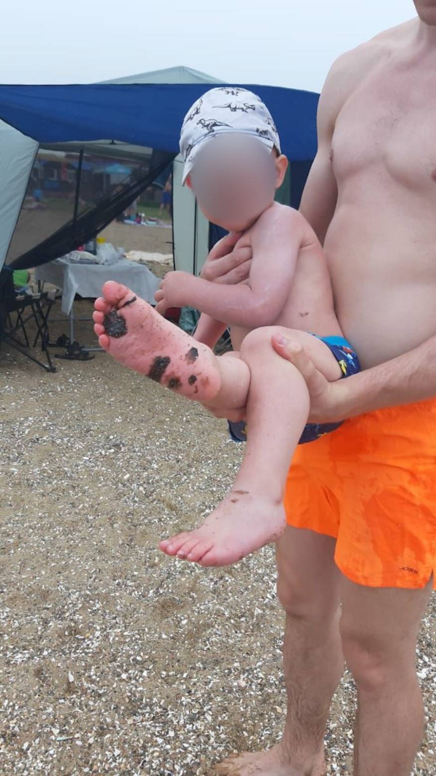 «Наступил на "мину"»: Десятки отдыхающих "вляпались" во время отдыха на Шаморе «Наступил на "мину"»: Десятки отдыхающих "вляпались" во время отдыха на Шаморе