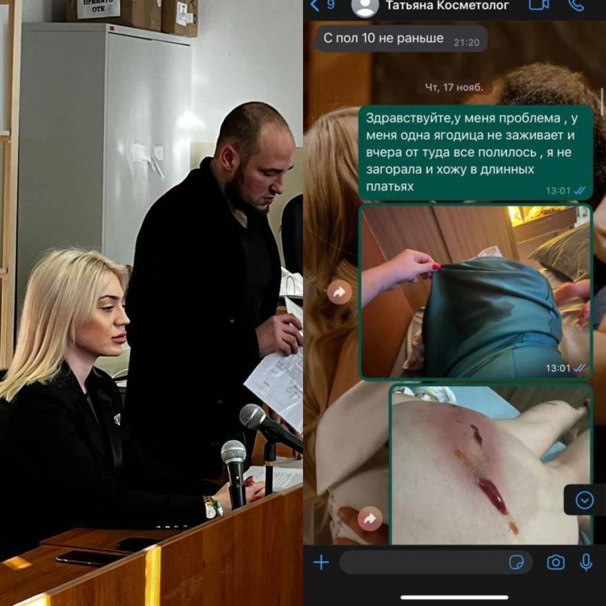 "Все вытекло": девушка требует компенсацию за неудачную операцию на ягодицах "Все вытекло": девушка требует компенсацию за неудачную операцию на ягодицах