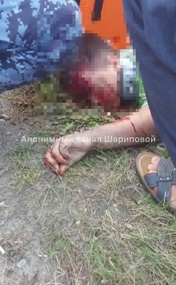 "Там голове плохо": в Находке автомобиль сбил ребенка на велосипеде