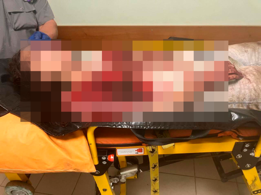 В Приморье мигрант жестоко избил девушку, которая отвергла его наглые ухаживания В Приморье мигрант жестоко избил девушку, которая отвергла его наглые ухаживания