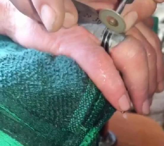 Спасатели помогли приморцу избавиться от кольца на пальце