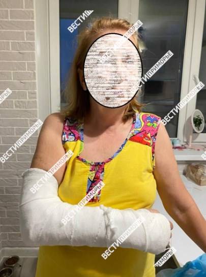 Жительница Приморья требует компенсации за сломанную после проведении колоноскопии руку