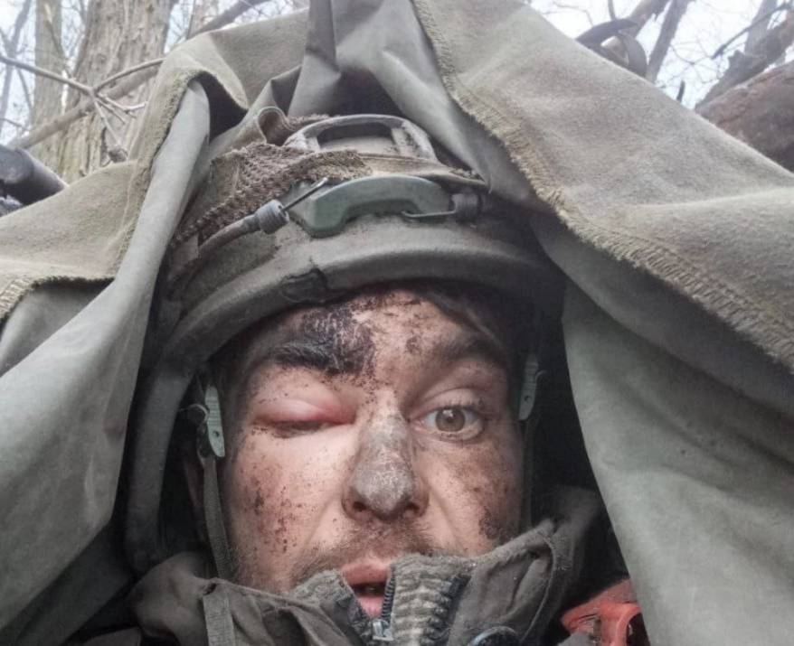 Морпех из Приморья неделю воевал с пулей в голове Морпех из Приморья неделю воевал с пулей в голове