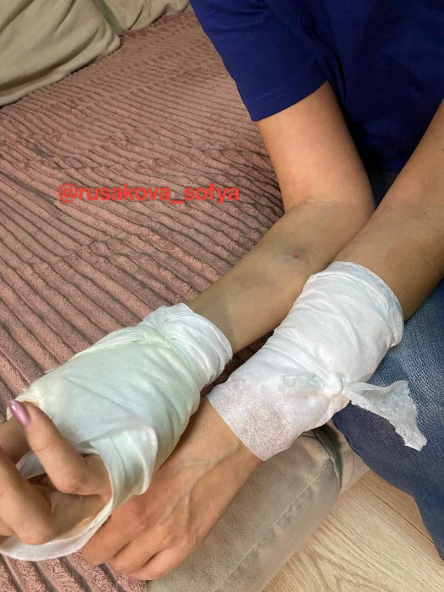 "Сижу и плачу": жительница Владивостока не может оправиться после нападения собаки