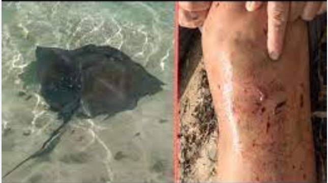 Ныряльщик серьезно пострадал от нападения ската в Приморье