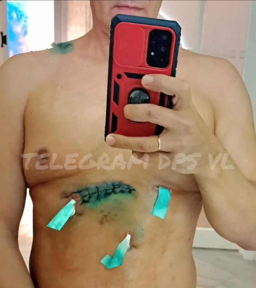 «Залез в постель»: неожиданно «жесткий» поворот в деле семьи из Приморья и мигранта