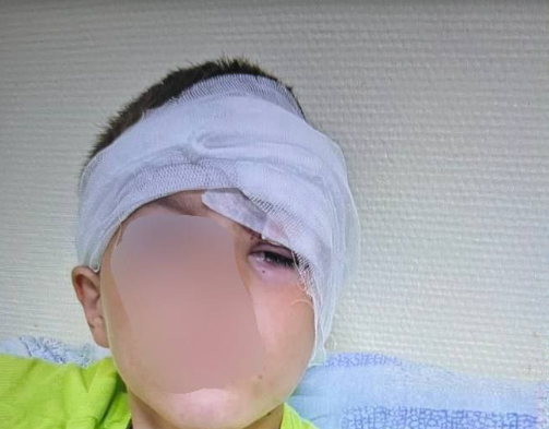Возбуждено уголовное дело по факту нападения собаки на ребенка в Приморье