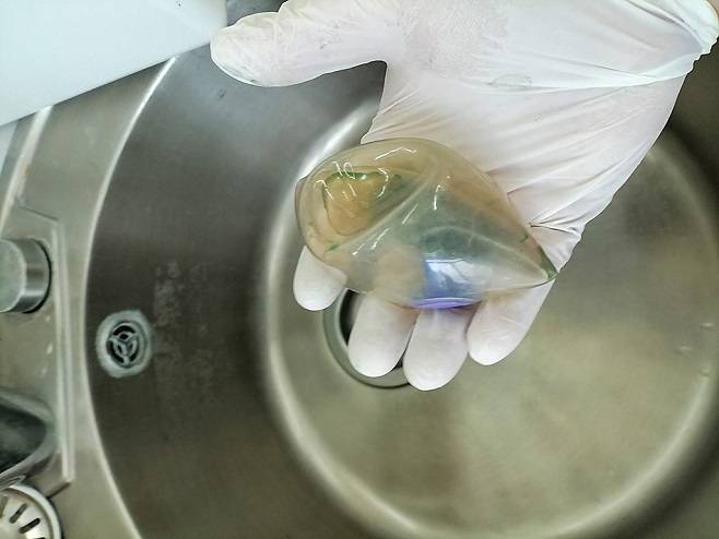 Баллон для похудения продырявил желудок жительнице Находки Баллон для похудения продырявил желудок жительнице Находки