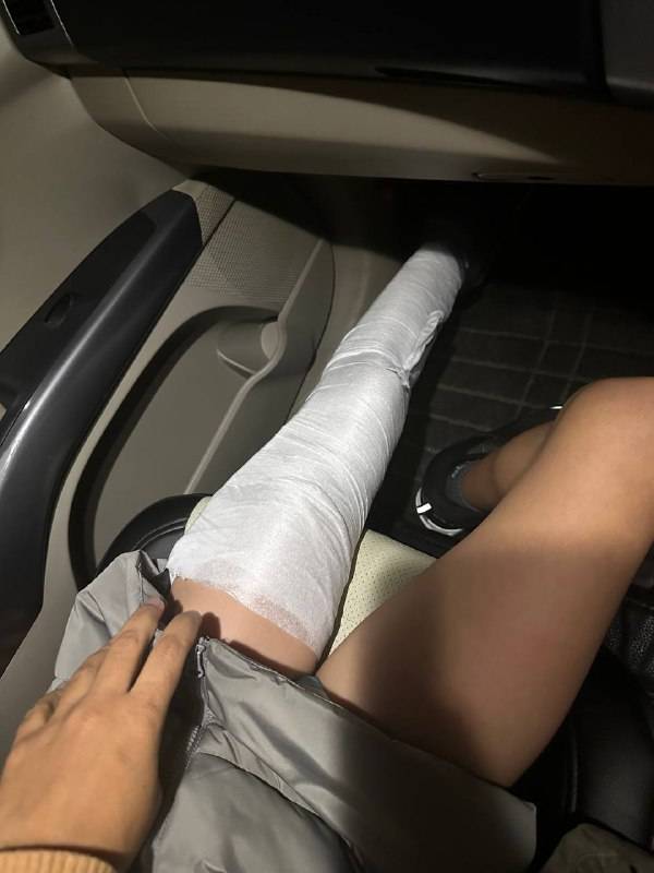 Во Владивостоке подросток, пережив шок, убежал с места ДТП на сломанной ноге