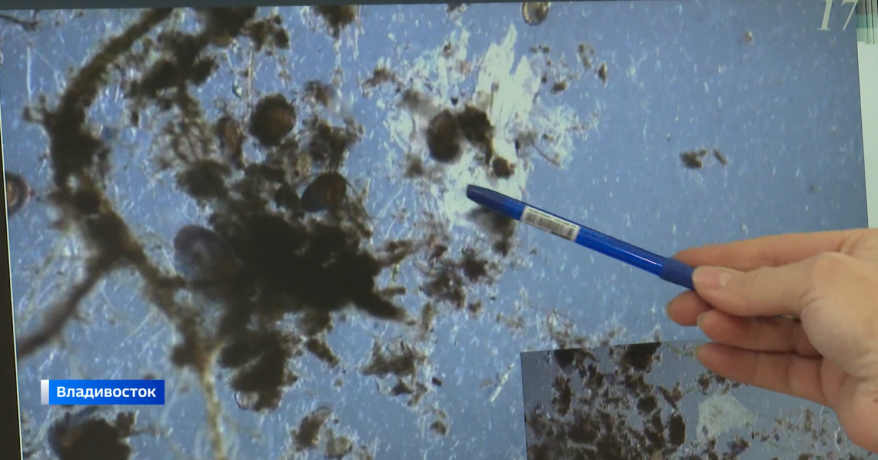 От рака до бесплодия: опасные для человека частицы обнаружили ученые в морепродуктах