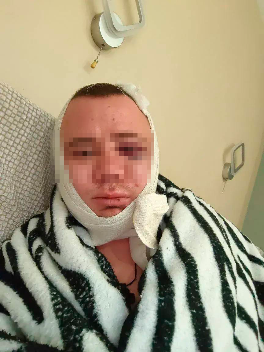 Переломом челюсти и носа обернулась для якутянина командировка во Владивосток