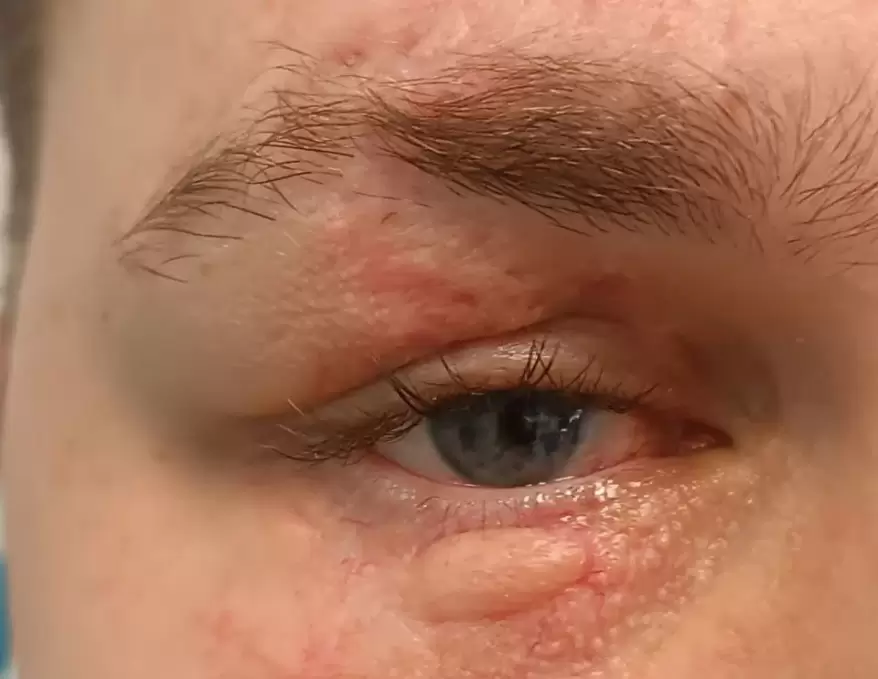 Владивостокские врачи спасли глаз мужчине, пострадавшему в страшном ДТП