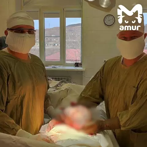 "Мурашки по коже": двух огромных "монстров" обнаружили врачи в теле жительницы Приморья