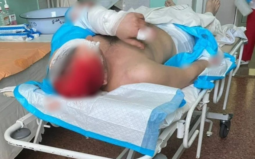 Мужчина чудом выжил после нападения медведицы в Приморье