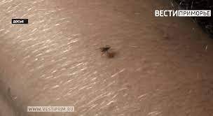 Первый случай клещевого энцефалита отмечен в Приморье