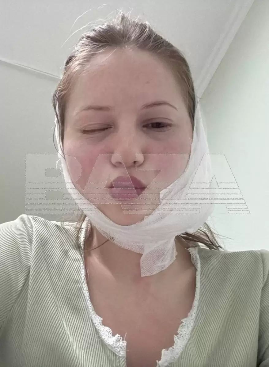 Во Владивостоке девушка хотела удалить зуб мудрости, а получила перекошенное лицо