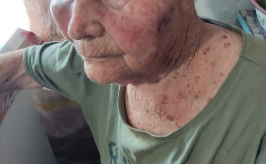 В Приморье дележ наследства обернулся жестоким избиением 85-летней пенсионерки